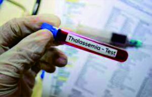 Thalassaemia, Penyakit Kelainan Darah yang Diturunkan secara Genetik dari Orangtua